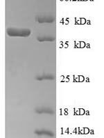 Human Cytochrome c (CYCS) Recombinant Protein, N-GST - BioCrest Sci