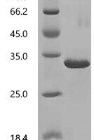 Artemisia vulgaris Profilin-1 Recombinant Protein, N-His-SUMOstar - BioCrest Sci