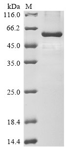 Human Paired box protein Pax-6 (PAX6) Recombinant Protein, Homo sapiens (Human), E.coli, N-terminal 6xHis-tagged, 52.6 kDa, purity >≥ 85% as determined by SDS-PAGE.
