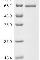 Human Atlastin-2 (ATL2), partial Recombinant Protein - BioCrest Sci