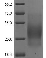 Human Interleukin-5 (IL5) Recombinant Protein, C-His - BioCrest Sci