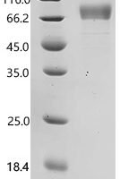 Human Atrial natriuretic peptide receptor 1 (NPR1), partial Recombinant Protein, C-10His - BioCrest Sci
