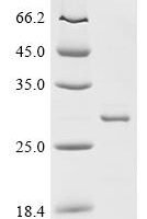 Escherichia coli Glutamate/aspartate import permease protein GltK (gltK), partial Recombinant Protein - BioCrest Sci
