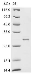 Escherichia coli Glutamate/aspartate import permease protein GltK (gltK), partial Recombinant Protein, Escherichia coli (strain K12), E.coli, N-terminal GST-tagged, 31.2 kDa, purity >≥ 85% as determined by SDS-PAGE.