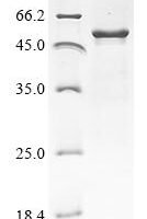 Rat Protein cereblon (Crbn) Recombinant Protein - BioCrest Sci