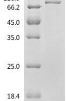 Human NACHT, LRR and PYD domains-containing protein 3 (NLRP3) (C279A), partial Recombinant Protein - BioCrest Sci