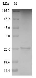 Toxoplasma gondii Dense granule protein 1 (GRA1) Recombinant Protein, Toxoplasma gondii, Yeast, N-terminal 6xHis-tagged, 19.9 kDa, purity >≥ 90% as determined by SDS-PAGE.