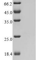 Human coronavirus HKU1 Non-structural protein 4 (4) Recombinant Protein, C-His, aa 1–109, Baculovirus - BioCrest Sci