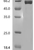 Human Somatostatin (SST), partial Recombinant Protein, C-hFc1 - BioCrest Sci