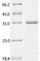 Porcine epidemic diarrhea virus Spike glycoprotein (S), partial Recombinant Protein, C-His, aa 19–278, E.coli - BioCrest Sci