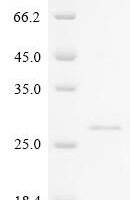 Bos indicus x Bos taurus Kappa-casein, partial Recombinant Protein, N-10His/C-Myc, aa 61–190 - BioCrest Sci