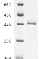 Mouse Transforming growth factor beta-1 proprotein (Tgfb1), partial Recombinant Protein, N-GST - BioCrest Sci