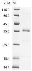 Mouse Transforming growth factor beta-1 proprotein (Tgfb1), partial Recombinant Protein, N-GST, Mus musculus (Mouse), E.coli, N-terminal GST-tagged, 40.3 kDa, purity >≥ 85% as determined by SDS-PAGE.