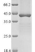 Human Interferon beta (IFNB1) Recombinant Protein, C-10His - BioCrest Sci