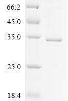 Human High affinity immunoglobulin gamma Fc receptor I (FCGR1A), partial Recombinant Protein - BioCrest Sci