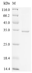 Human High affinity immunoglobulin gamma Fc receptor I (FCGR1A), partial Recombinant Protein, Homo sapiens (Human), E.coli, N-terminal 6xHis-tagged, 35.3 kDa, purity >≥ 85% as determined by SDS-PAGE.
