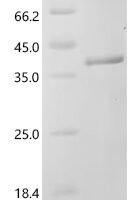 Human Granzyme K (GZMK) Recombinant Protein, C-10His - BioCrest Sci