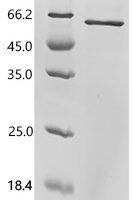 Human Mothers against decapentaplegic homolog 3(SMAD3) Recombinant Protein - BioCrest Sci