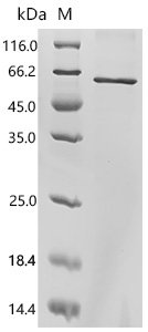 Human Mothers against decapentaplegic homolog 3(SMAD3) Recombinant Protein, Homo sapiens (Human), E.coli, C-terminal 6xHis-tagged, 55.1 kDa, purity >≥ 85% as determined by SDS-PAGE.