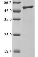 Bovine coronavirus Nucleoprotein (N) Recombinant Protein, C-His, aa 1–448, strain OK-0514 - BioCrest Sci