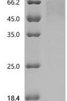 Human Transcription factor SOX-1 (SOX1) Recombinant Protein, C-mFc2a - BioCrest Sci