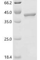 Bovine Pyrroline-5-carboxylate reductase 2 (PYCR2) Recombinant Protein - BioCrest Sci