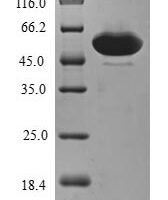 Human AN1-type zinc finger protein 3 (ZFAND3) Recombinant Protein - BioCrest Sci
