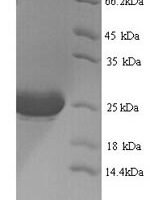 Macaca mulatta Interleukin-1 alpha (IL1A) Recombinant Protein - BioCrest Sci