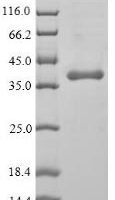 Human Protein Wnt-5a (WNT5A) Recombinant Protein, N-His - BioCrest Sci
