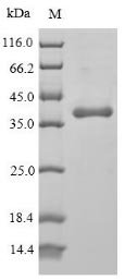 Human Protein Wnt-5a (WNT5A) Recombinant Protein, N-His, Homo sapiens (Human), Yeast, N-terminal 6xHis-tagged, 37.8 kDa, purity >≥ 90% as determined by SDS-PAGE.