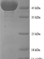 Human Peroxiredoxin-1 (PRDX1) Recombinant Protein, N-GST - BioCrest Sci