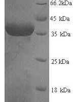 Human Squamous cell carcinoma antigen recognized by T-cells 3 (SART3), partial Recombinant Protein, N-His - BioCrest Sci