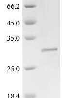 Human Putative ATP-dependent RNA helicase TDRD12 (TDRD12), partial Recombinant Protein - BioCrest Sci