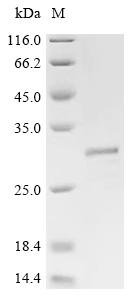Human Putative ATP-dependent RNA helicase TDRD12 (TDRD12), partial Recombinant Protein, Homo sapiens (Human), E.coli, N-terminal 6xHis-tagged and C-terminal Avi-tagged, 28.3 kDa, purity >≥ 85% as determined by SDS-PAGE.