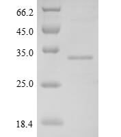 Human Fibronectin type III domain-containing protein 5 (FNDC5), partial Recombinant Protein - BioCrest Sci