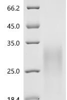 Mouse Interleukin-13 (Il13) Recombinant Protein, C-10His - BioCrest Sci