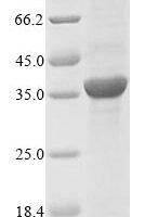 Escherichia coli Penicillin-binding protein 1B (mrcB), partial Recombinant Protein - BioCrest Sci