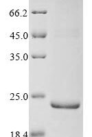 Bovine Inter-alpha-trypsin inhibitor heavy chain H2 (ITIH2) Recombinant Protein - BioCrest Sci