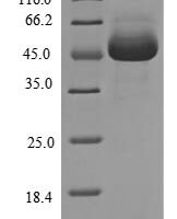 Human Receptor-interacting serine/threonine-protein kinase 1 (RIPK1), partial Recombinant Protein, N-10His/C-Myc - BioCrest Sci
