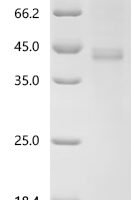 Human Protein Wnt-5a (WNT5A) Recombinant Protein, N-Flag/C-His - BioCrest Sci