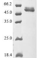 Human Prolactin (PRL) Recombinant Protein - BioCrest Sci