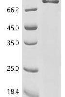 Rat Tyrosine-protein kinase receptor TYRO3 (Tyro3), partial Recombinant Protein, C-hFc1 - BioCrest Sci