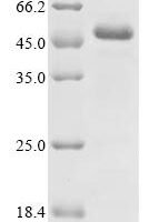 Human DNA polymerase beta (POLB) Recombinant Protein, N-His-SUMOstar - BioCrest Sci