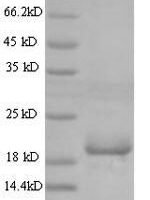 Mouse Angiopoietin-like protein 8 (Angptl8) Recombinant Protein, N-His, aa 16–198, Yeast - BioCrest Sci