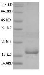 Mouse Angiopoietin-like protein 8 (Angptl8) Recombinant Protein, N-His, aa 16–198, Yeast, Mus musculus (Mouse), Yeast, N-terminal 6xHis-tagged, 22.5 kDa, purity >≥ 90% as determined by SDS-PAGE.