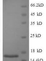 Human Acrosomal protein SP-10 (ACRV1) Recombinant Protein - BioCrest Sci