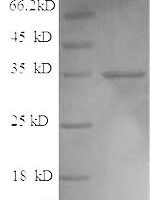 Bacillus thuringiensis subsp. Pesticidal crystal protein cry1Fb (cry1Fb), partial Recombinant Protein, N-His - BioCrest Sci