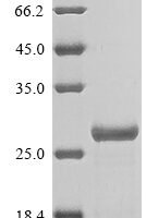 Rat Alpha-1-acid glycoprotein (Orm1) Recombinant Protein - BioCrest Sci