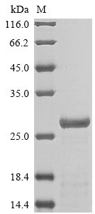 Rat Alpha-1-acid glycoprotein (Orm1) Recombinant Protein, Rattus norvegicus (Rat), E.coli, N-terminal 6xHis-tagged, 25.7 kDa, purity >≥ 85% as determined by SDS-PAGE.