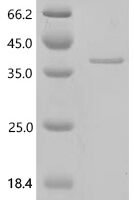 Human Transaldolase (TALDO1) Recombinant Protein, C-His, aa 1–337, Yeast - BioCrest Sci